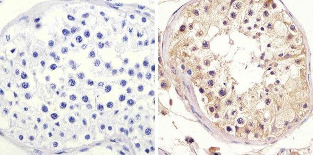 mTOR Antibody in Immunohistochemistry (Paraffin) (IHC (P))