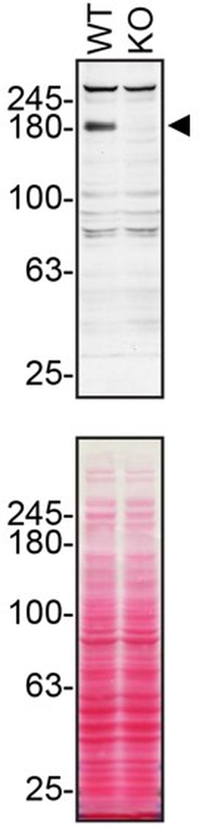 TSC2 Antibody in Western Blot (WB)