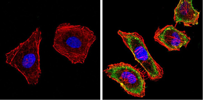 EGFR Antibody in Immunocytochemistry (ICC/IF)