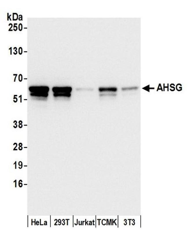 AHSG/Fetuin-A Antibody in Western Blot (WB)