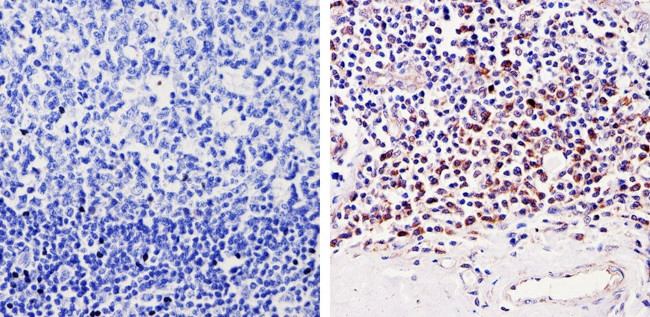 CDK6 Antibody in Immunohistochemistry (Paraffin) (IHC (P))