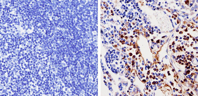 CDK6 Antibody in Immunohistochemistry (Paraffin) (IHC (P))