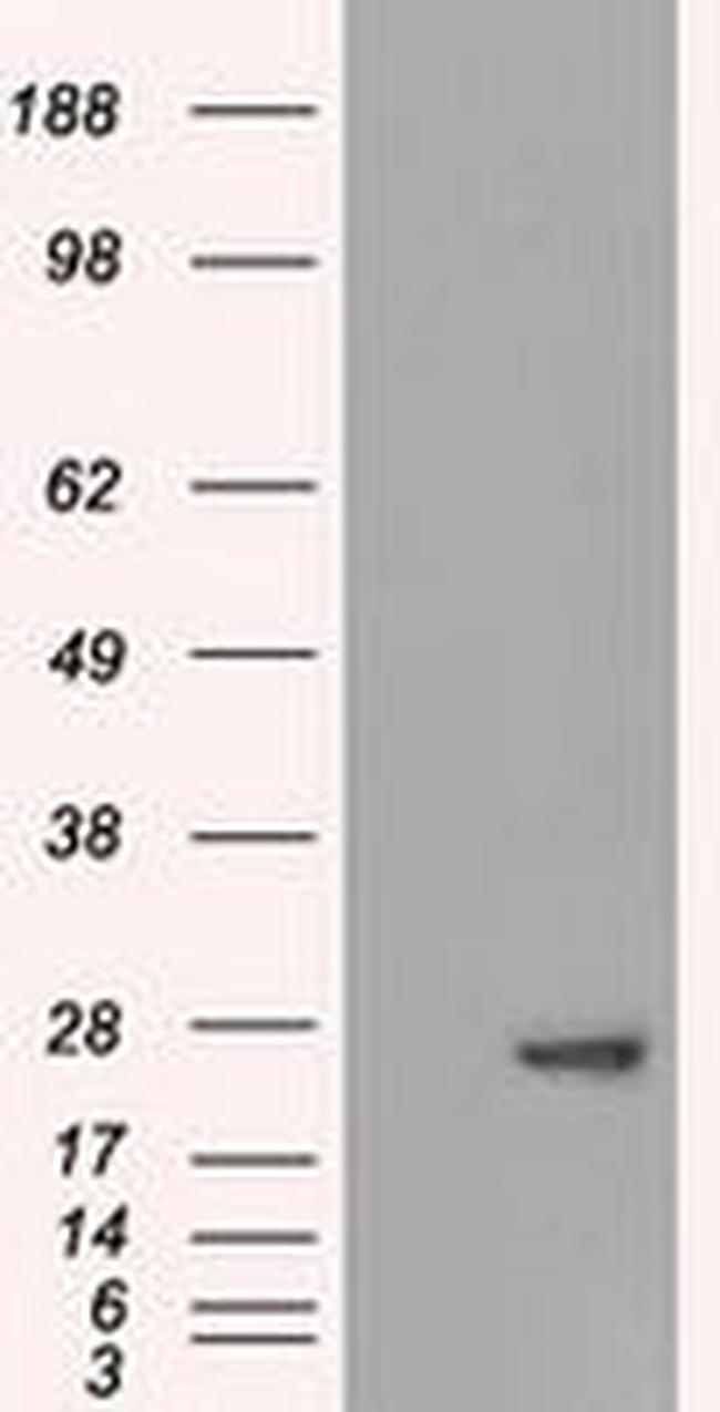 AK1 Antibody in Western Blot (WB)