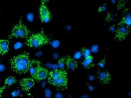 AK4 Antibody in Immunocytochemistry (ICC/IF)