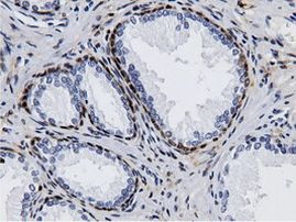 AK5 Antibody in Immunohistochemistry (Paraffin) (IHC (P))