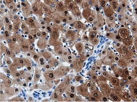 AK5 Antibody in Immunohistochemistry (Paraffin) (IHC (P))