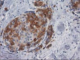 AK5 Antibody in Immunohistochemistry (Paraffin) (IHC (P))