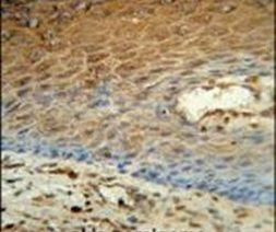 Adenylate Kinase 7 Antibody in Immunohistochemistry (IHC)