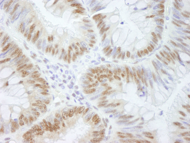 AKAP8/AKAP95 Antibody in Immunohistochemistry (IHC)