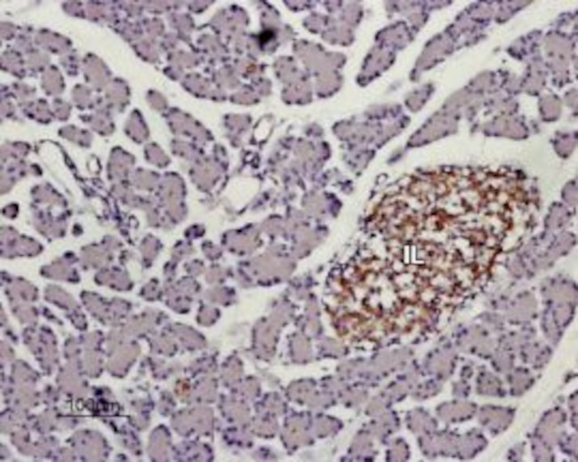 KISS1 Receptor (GPR54) (extracellular) Antibody in Immunohistochemistry (Paraffin) (IHC (P))