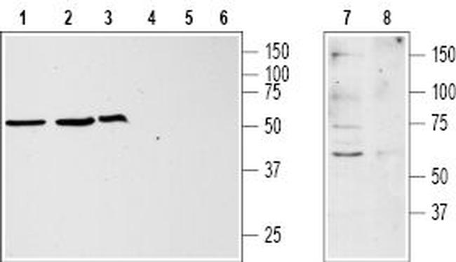 KISS1 Receptor (GPR54) (extracellular) Antibody in Western Blot (WB)