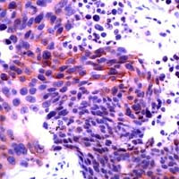 AKT1/AKT2 Antibody in Immunohistochemistry (IHC)