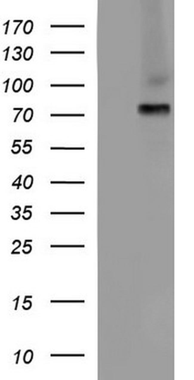 ALB Antibody in Western Blot (WB)