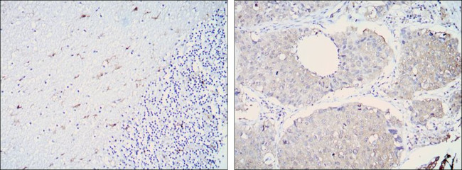 ALDH1A1 Antibody in Immunohistochemistry (Paraffin) (IHC (P))