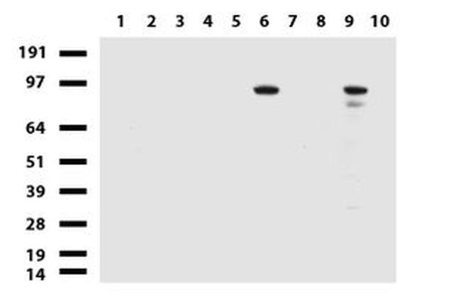 ALDH1L1 Antibody in Western Blot (WB)