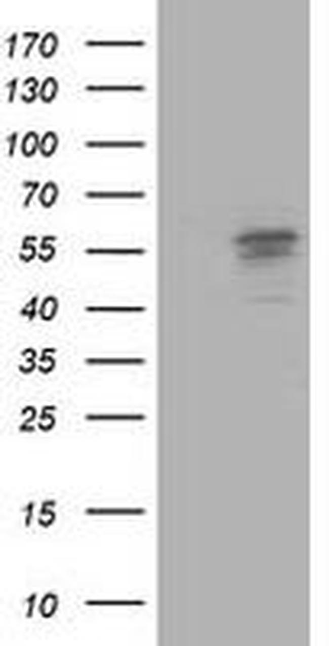 ALDH3A2 Antibody in Western Blot (WB)