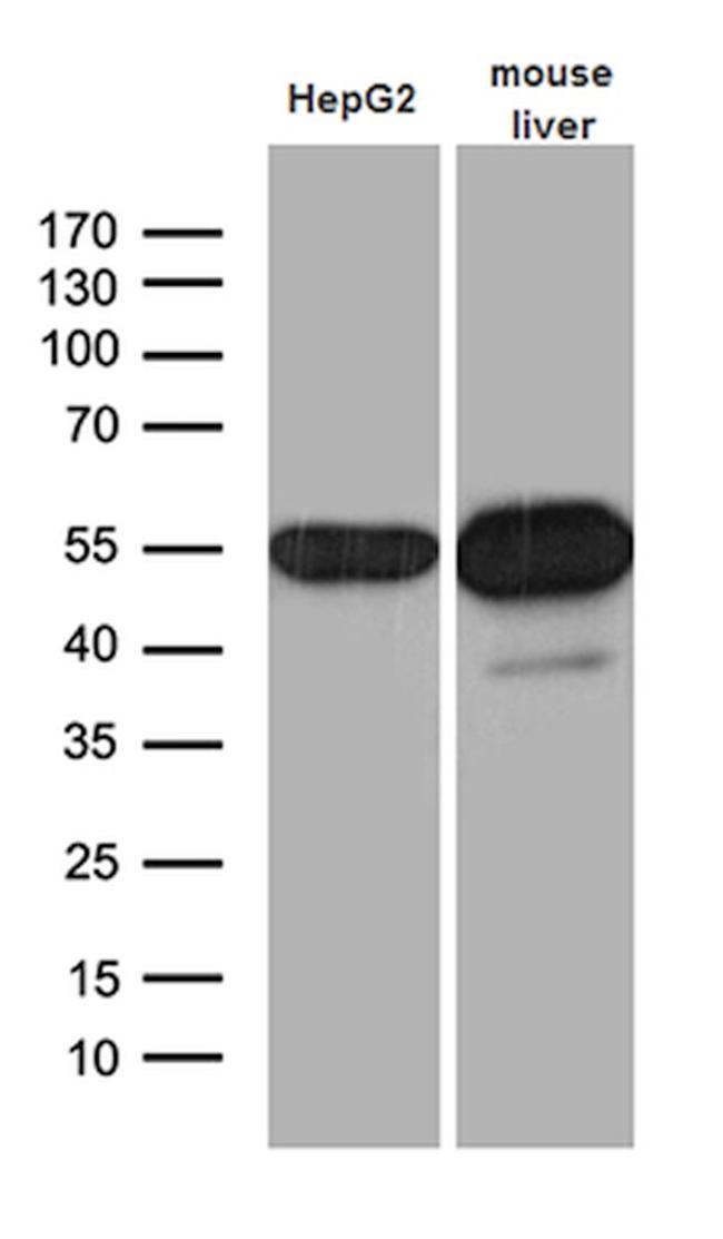 ALDH7A1 Antibody in Western Blot (WB)