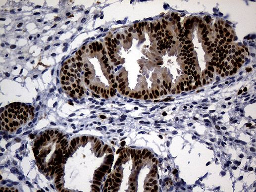 ALOX5 Antibody in Immunohistochemistry (Paraffin) (IHC (P))