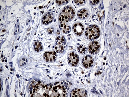 ALOX5 Antibody in Immunohistochemistry (Paraffin) (IHC (P))