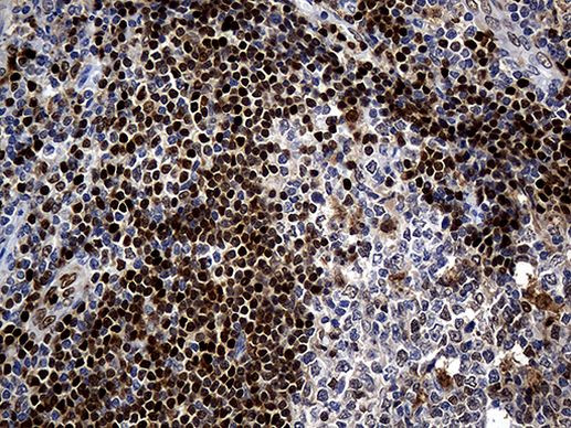 ALOX5 Antibody in Immunohistochemistry (Paraffin) (IHC (P))