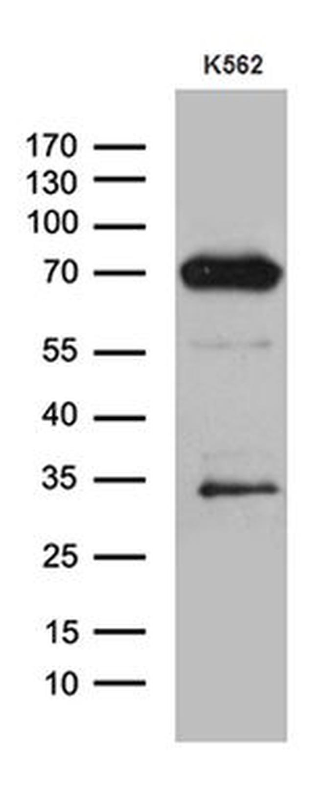 ALOX5 Antibody in Western Blot (WB)