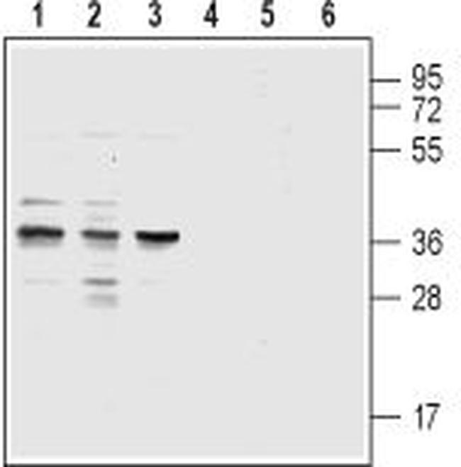 CysLTR1 (extracellular) Antibody in Western Blot (WB)