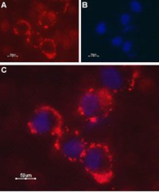 Latrophilin-1 (LPHN1) (extracellular) Antibody in Immunocytochemistry (ICC/IF)