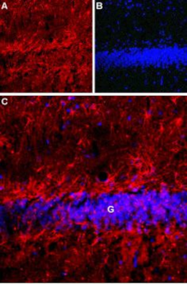 Latrophilin-1 (LPHN1) (extracellular) Antibody in Immunohistochemistry (IHC)