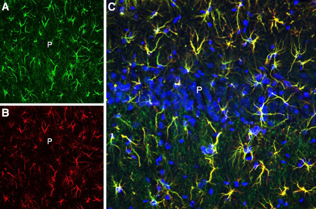 CLEC7A/Dectin-1 (extracellular) Antibody in Immunohistochemistry (Frozen) (IHC (F))