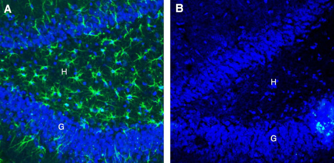 CLEC7A/Dectin-1 (extracellular) Antibody in Immunohistochemistry (Frozen) (IHC (F))