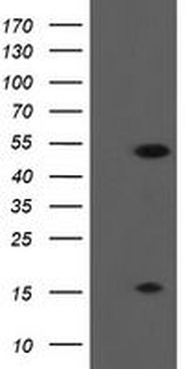 ALX4 Antibody in Western Blot (WB)