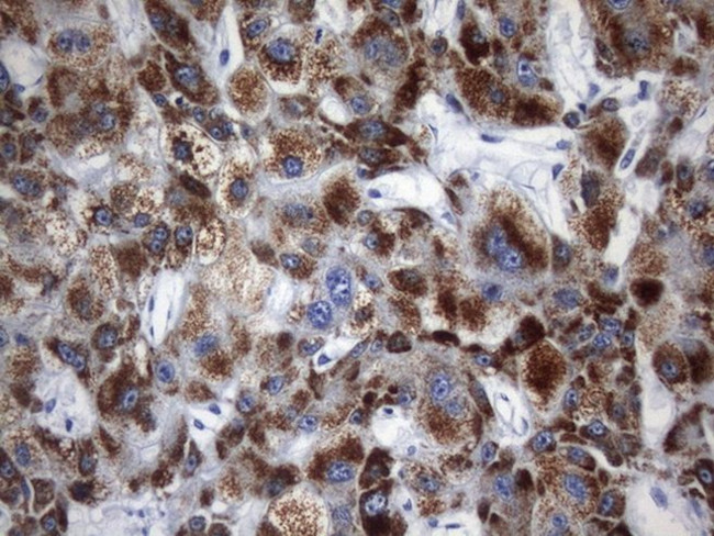 AMACR Antibody in Immunohistochemistry (Paraffin) (IHC (P))