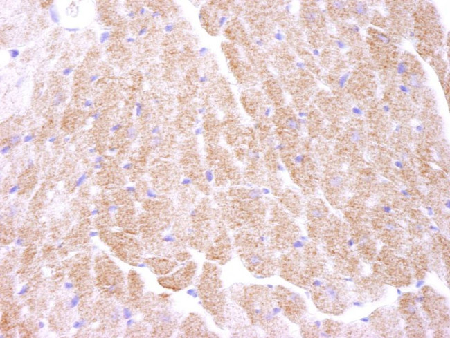 AMPK alpha 1 Antibody in Immunohistochemistry (IHC)