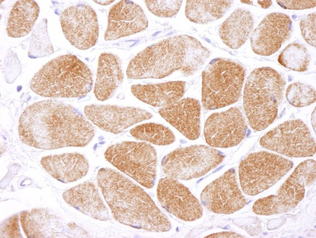 AMPK alpha 1 Antibody in Immunohistochemistry (IHC)