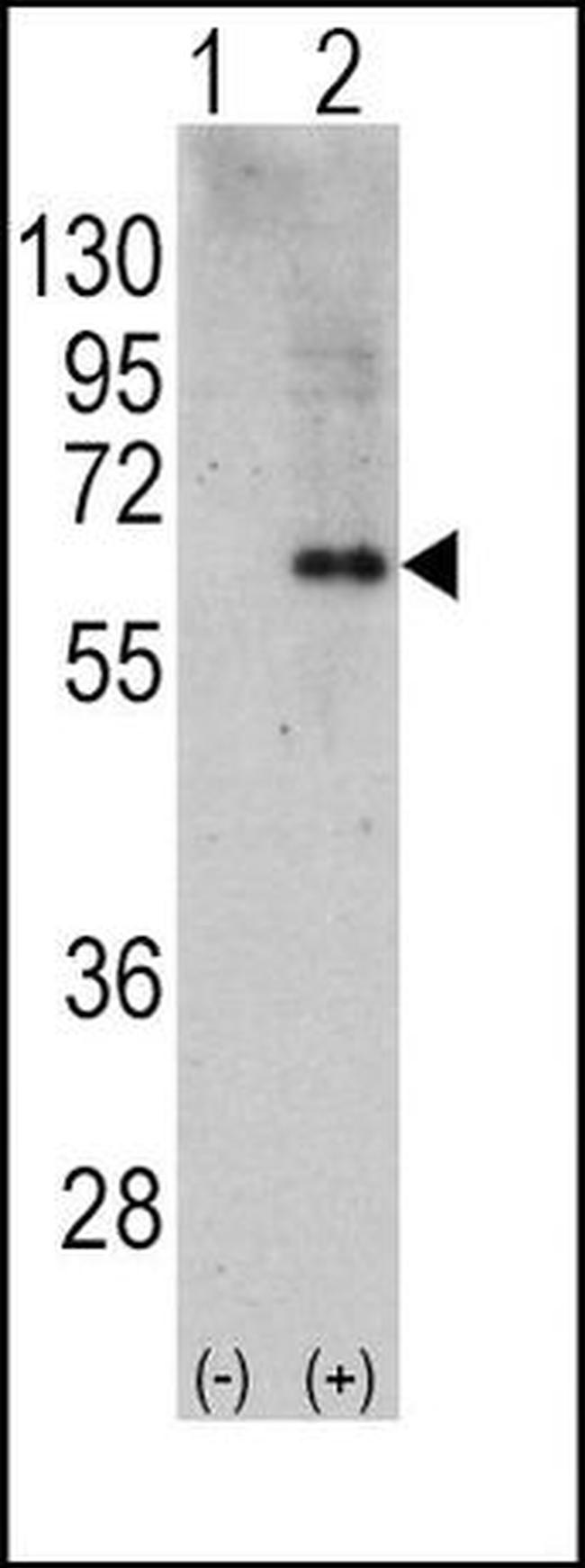 AMPK alpha-2 Antibody in Western Blot (WB)