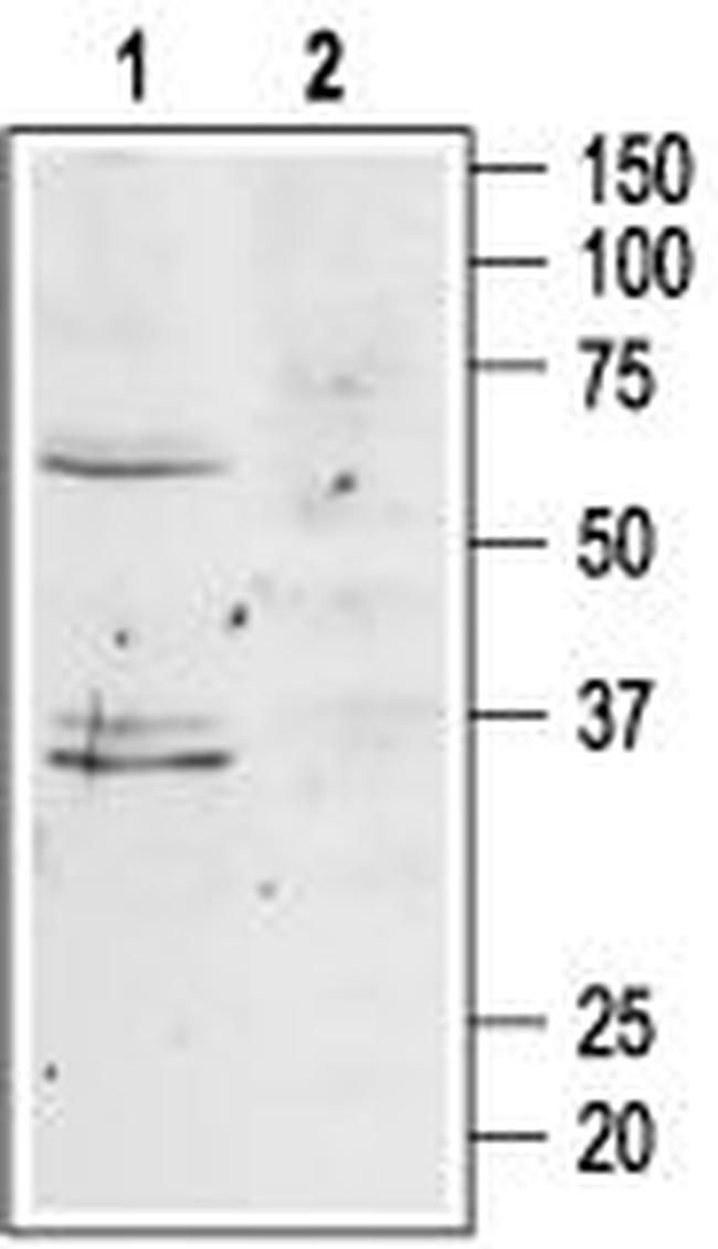 MC4 Receptor (extracellular) Antibody in Western Blot (WB)