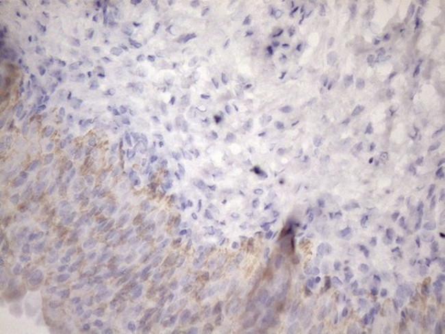 AMTN Antibody in Immunohistochemistry (Paraffin) (IHC (P))