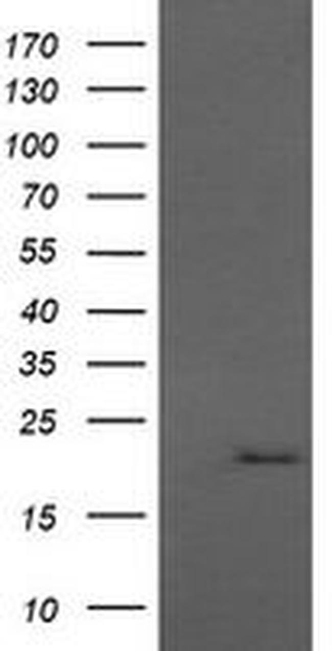 ANAPC11 Antibody in Western Blot (WB)