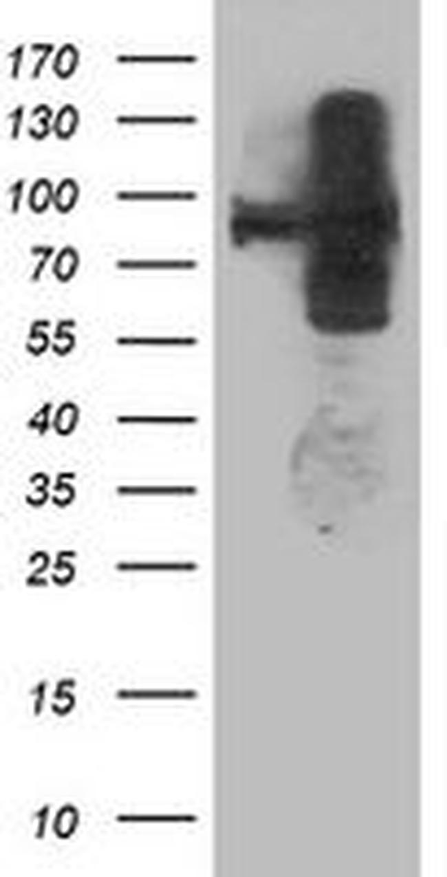 ANAPC2 Antibody in Western Blot (WB)