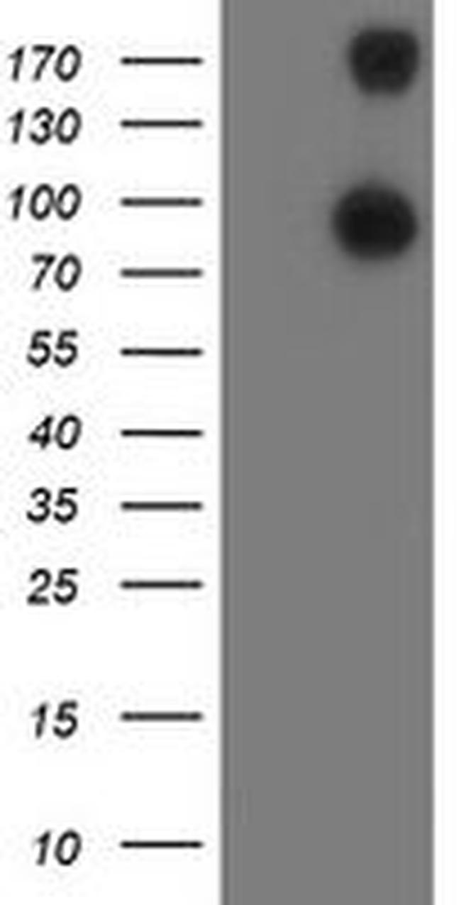 ANAPC2 Antibody in Western Blot (WB)