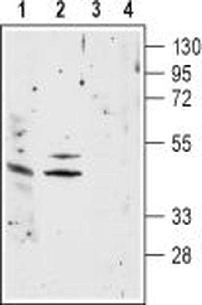 Nicotinic Acetylcholine Receptor alpha 1 (CHRNA1) (extracellular) Antibody in Western Blot (WB)