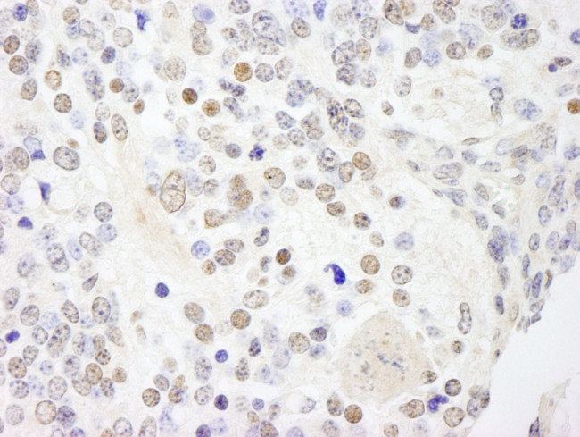 ANKS3 Antibody in Immunohistochemistry (IHC)