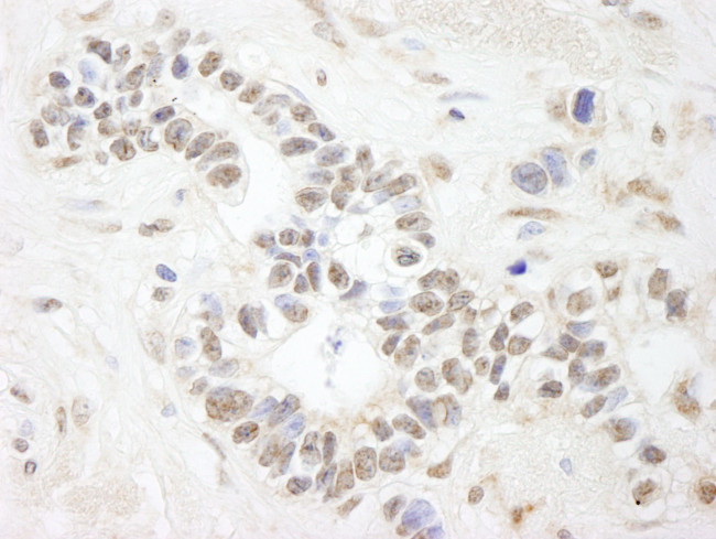 ANKS3 Antibody in Immunohistochemistry (IHC)