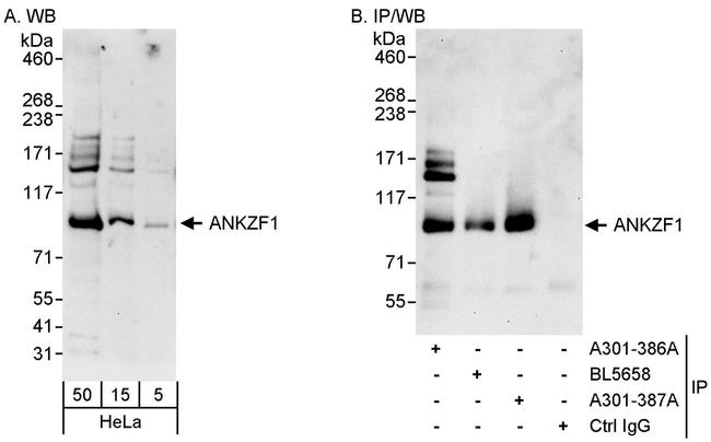 ANKZF1 Antibody in Western Blot (WB)