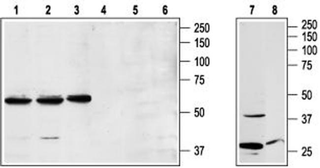 NPY1R Antibody in Western Blot (WB)