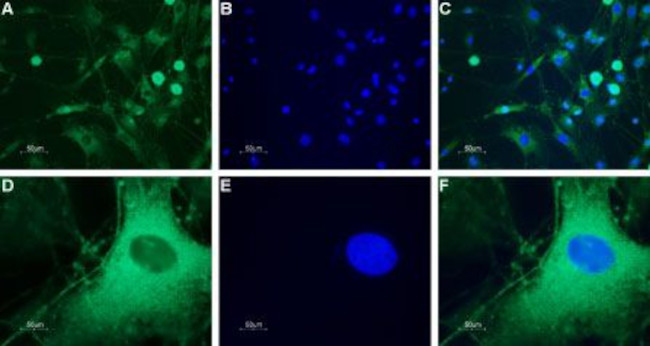 NPY5R Antibody in Immunocytochemistry (ICC/IF)