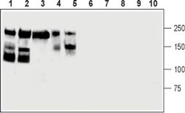 CD56/NCAM1 (extracellular) Antibody in Western Blot (WB)