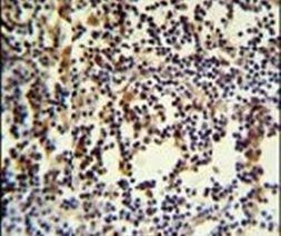 ANR49 Antibody in Immunohistochemistry (IHC)