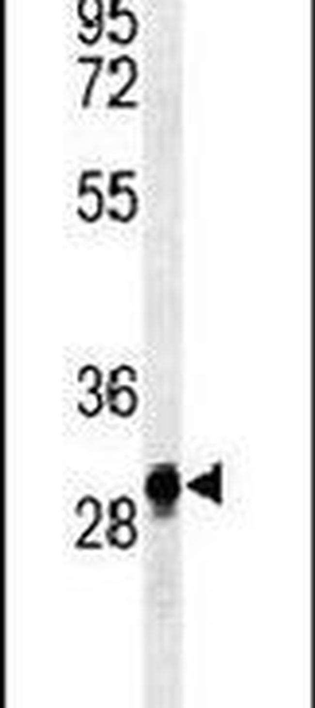 ANR49 Antibody in Western Blot (WB)