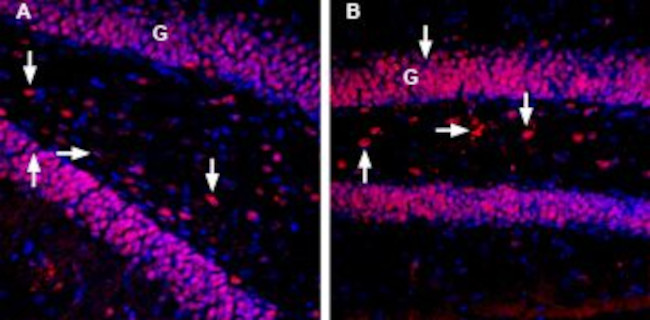 MANF/ARMET Antibody in Immunohistochemistry (IHC)